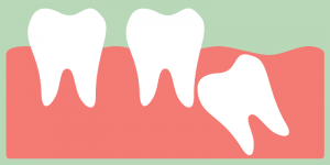 Wisdom tooth growing in 